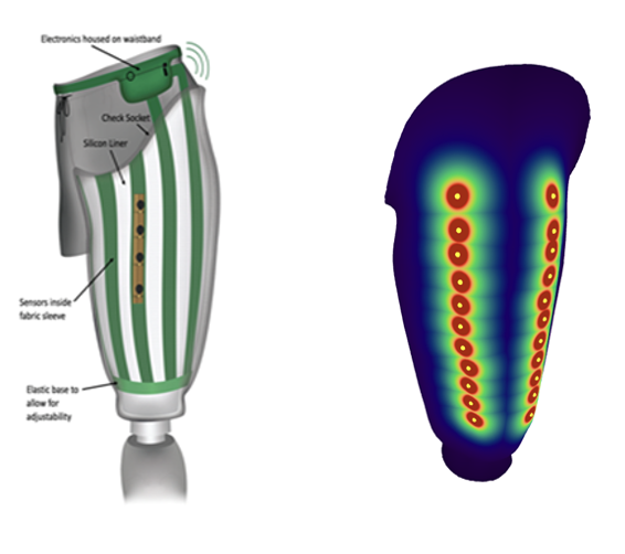 AR-SmartMap Prosthetic Pressure Mapping System